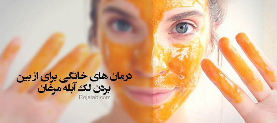 درمان لک آبله مرغان